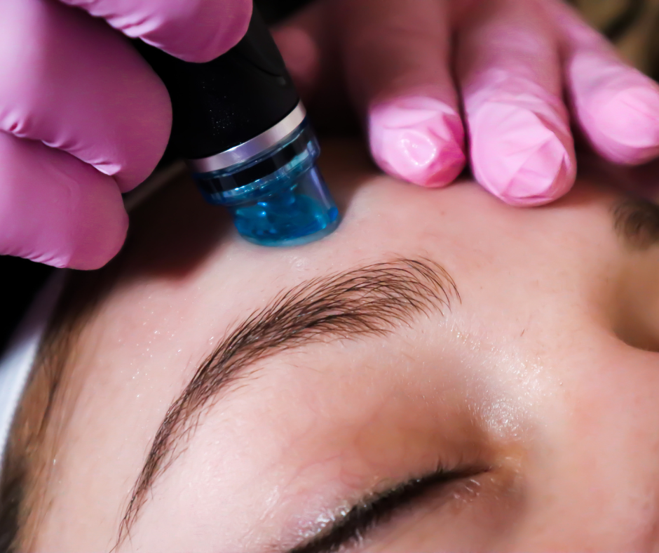 Extracting-with-Hydrafacial-Facelogic