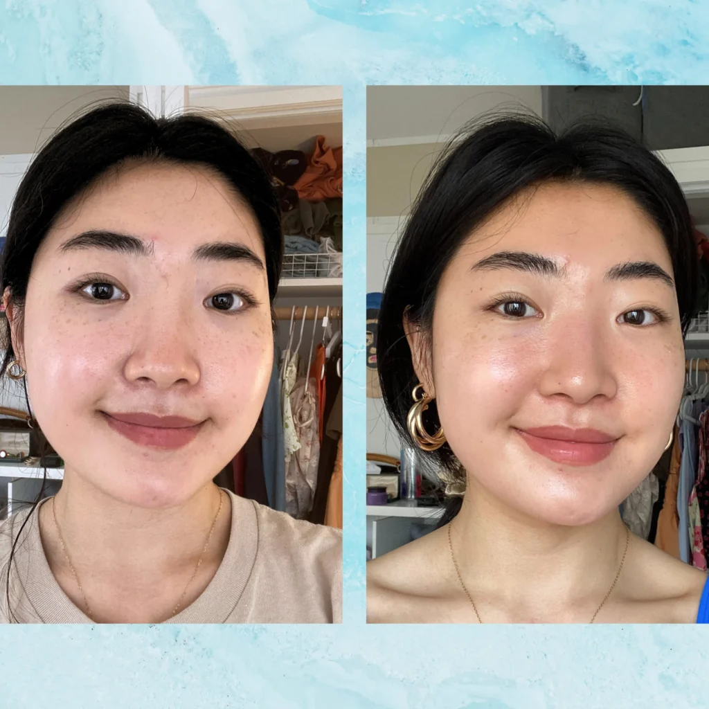 I Tried HydraFacial
