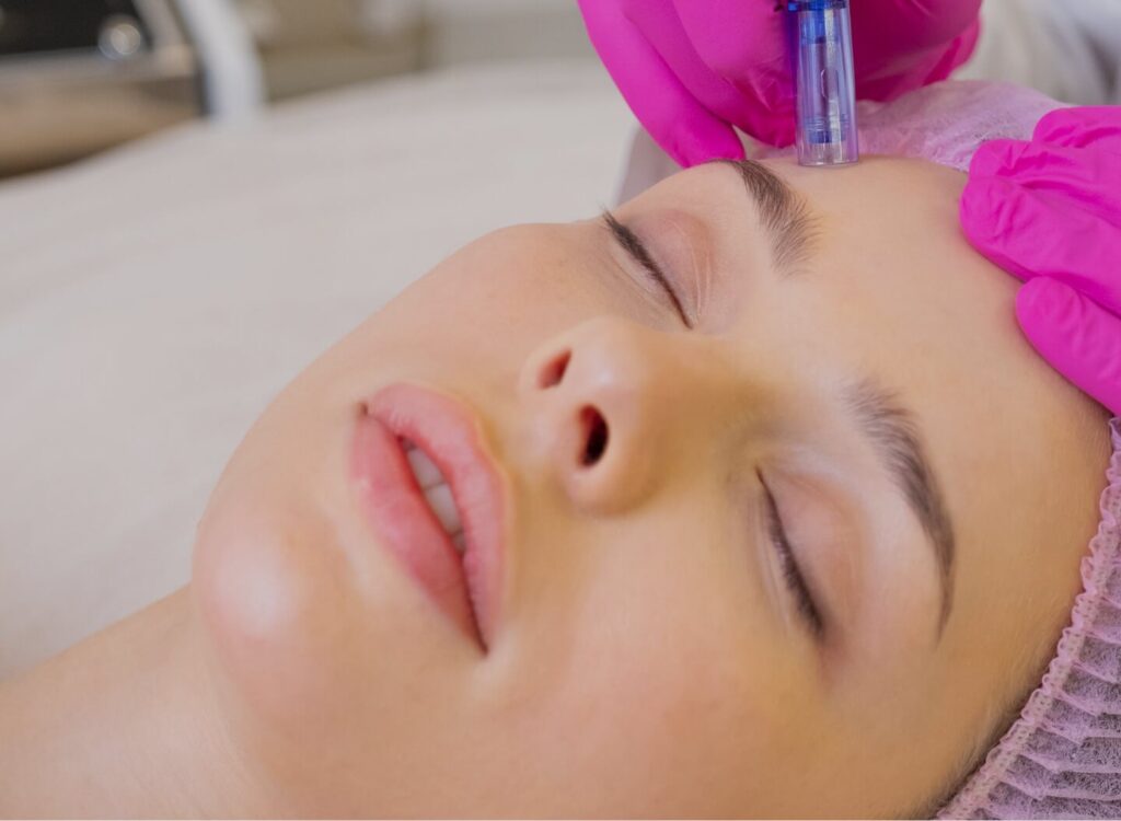 dermapen