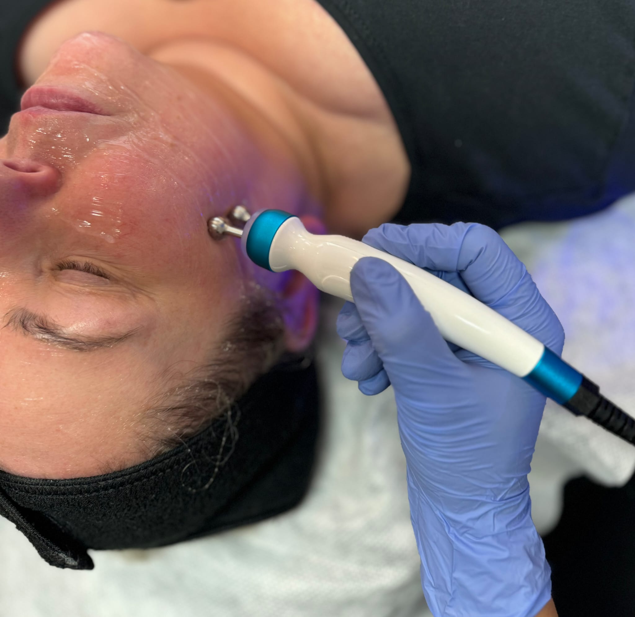 Hydrafacial – hoidon yksityiskohta 1