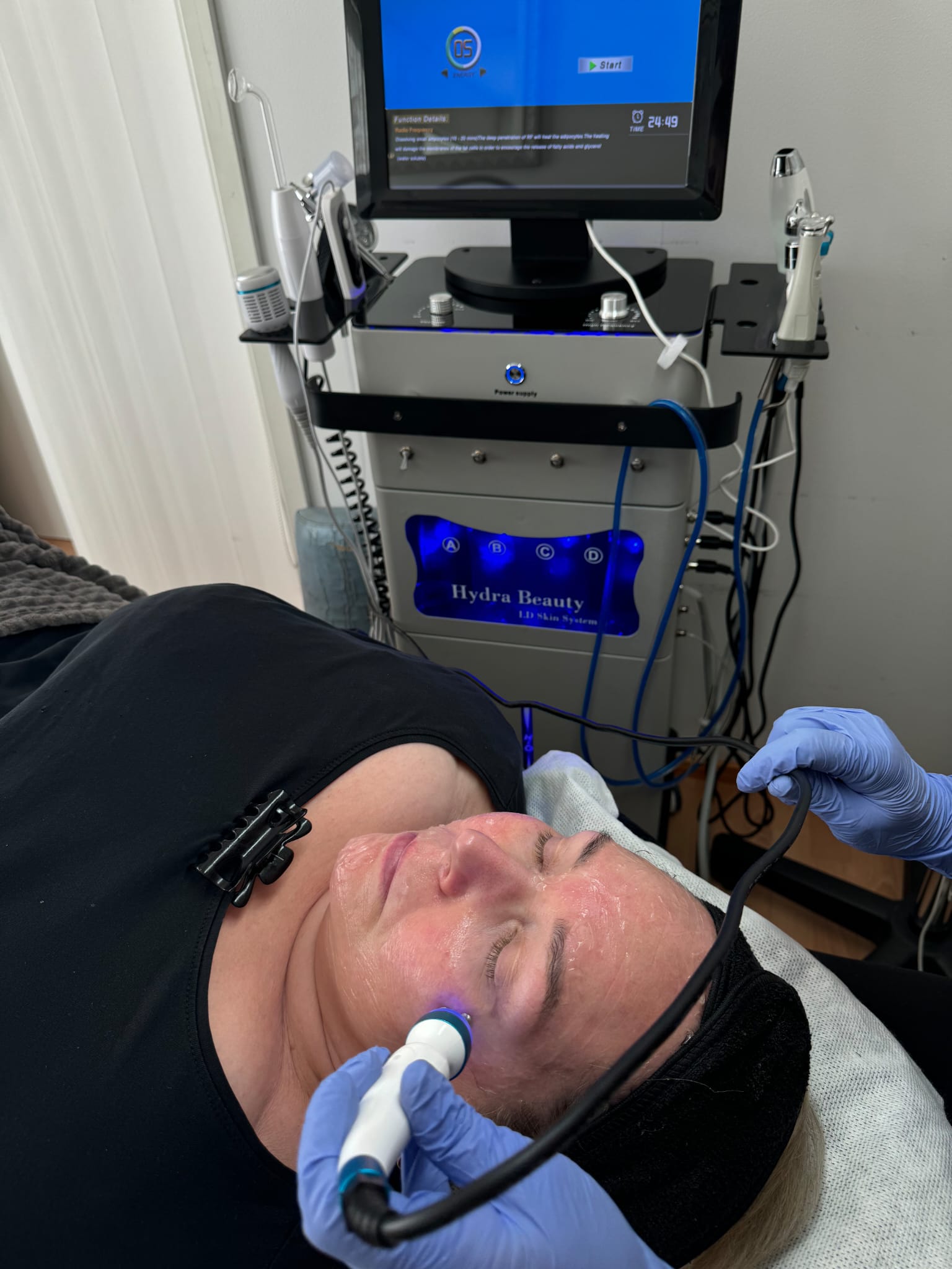 Hydrafacial – tuloskuva 2