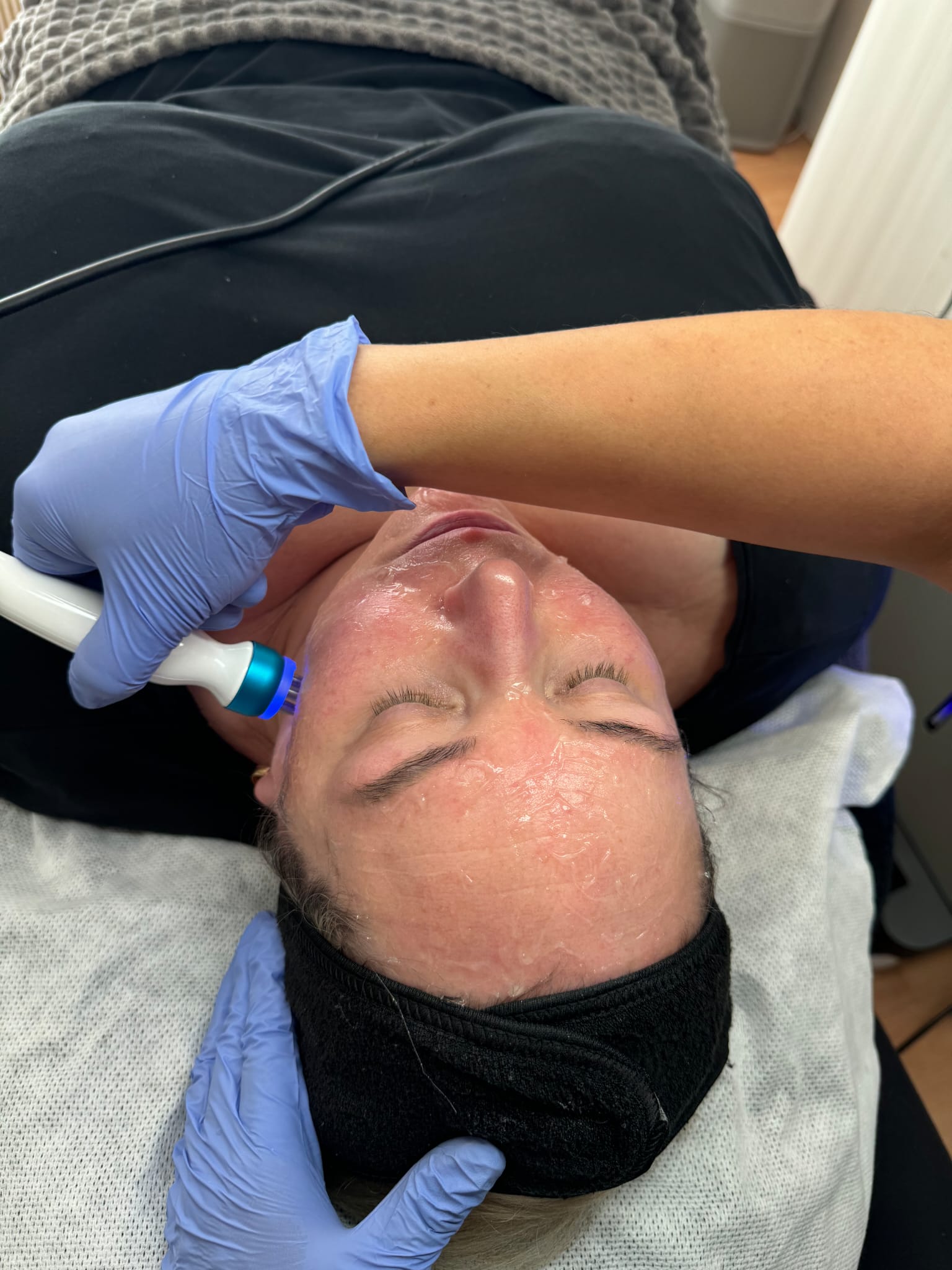Hydrafacial – hoidon yksityiskohta 2